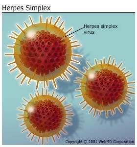 virut hsv gây mụn rộp sinh dục