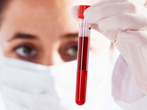 Xét nghiệm máu để xác định nguyên nhân gây bệnh