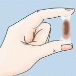 huyết trắng màu nâu